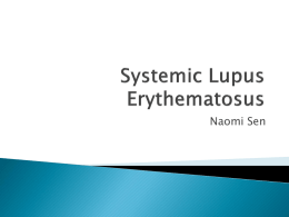 Systemic Lupus Erythematosus