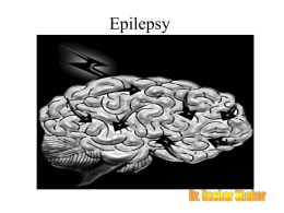 Generalized seizures