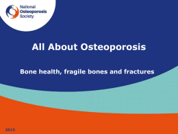 All about osteoporosis: bone health, fragile bones and fractures
