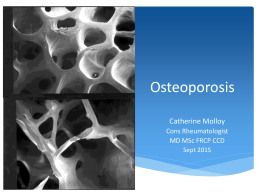 Osteoporosis update - Bon Secours Hospitals