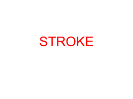 STROKE - UCSD Cognitive Science