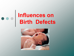 birth defect