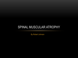 Spinal Muscular Atrophy 2