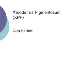 Xeroderma Pigmentosum (XP)