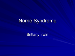 Norrie Syndrome - Bellarmine University