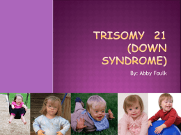 Tricamy 21 (Down Syndrome)