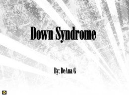 Down Syndrome - local.brookings.k12.sd.us