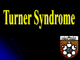 Turner Syndrome Lect