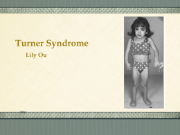 Turner Syndrome Lily Ou What is it?