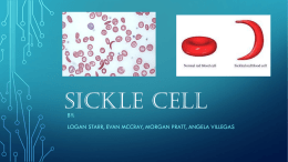 Sickle Cell PPT