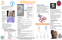 Albinism Posterx - Harlem Children Society