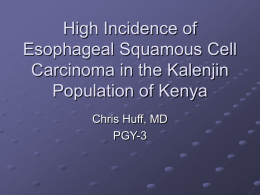 High Incidence of Esophageal Squamous Cell Carcinoma in