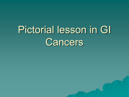 Pictorial lesson in GI cancers