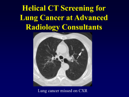 Why screen for lung cancer?