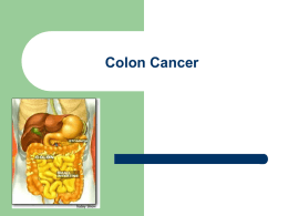 Colon_Cancer