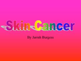 jarrah skin cancer