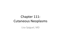Chapter 111: Cutaneous Neoplasms