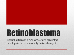 Retinoblastoma - Sacred Heart Academy