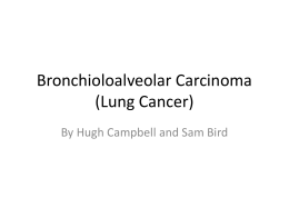 Lung cancer slide showx