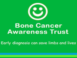 How did we do this? - Bone Cancer Awareness Trust