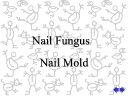 Nail Fungus - TeacherWeb