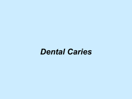 Dental Caries - TOP Recommended Websites