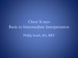 Chest X-Rays – Basic to Intermediate Interpretation – Phillip Smith