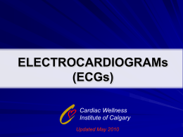 Electrocardiogram