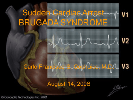 Sudden Cardiac Death BRUGADA SYNDROME