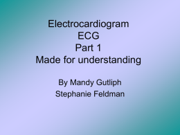 Electrocardiagram ECG