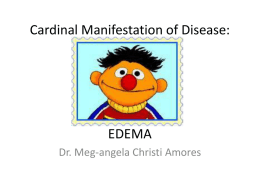 Cardinal Manifestation of Disease: EDEMA