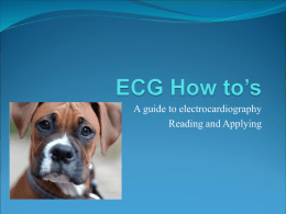 ECG How to’s - CecchiniCuore