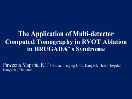The Role of MDCT scan in RVOT Ablation in BRUGADA’ s Syndrome