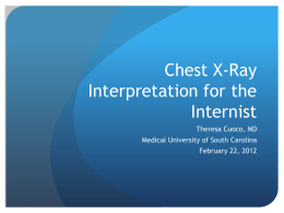 Chest X-Ray Interpretation for the Internist