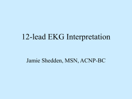 12-Lead EKG Interpretation - Mississippi Nurses Association