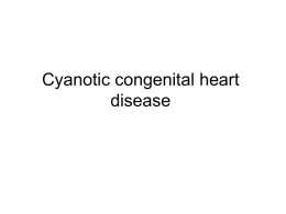2-cyanotic congental heart diseases