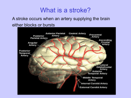 Stroke: an introduction