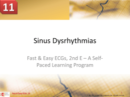 sinus rhythm with first degree AV block