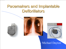 Pacemakers and Implantable Defibrillators
