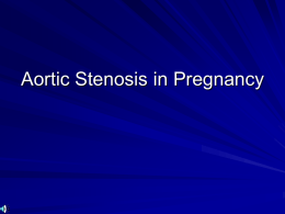 aorticStenosisPregnancy