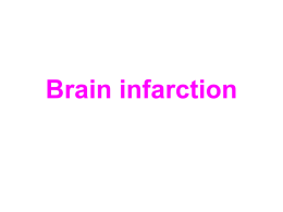 Diagnostics of Brain Infarction