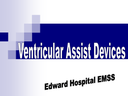 Left Ventricular Assist Device - Edward