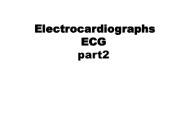 Electrocardiographs ECG part2
