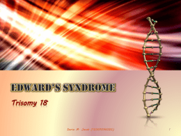 Edward`s Syndrome