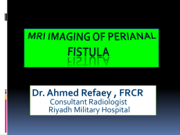 MRI imaging of Perianal fistula