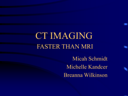 ct imaging faster than mri