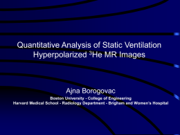 Quantitative Analysis of Static Ventilation