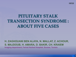 Interruption of the pituitary stalk