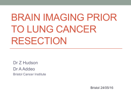 Brain imaging prior to lung cancer resection