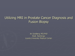 MultiParametric Prostate MRI and MR/US fusion biopsy